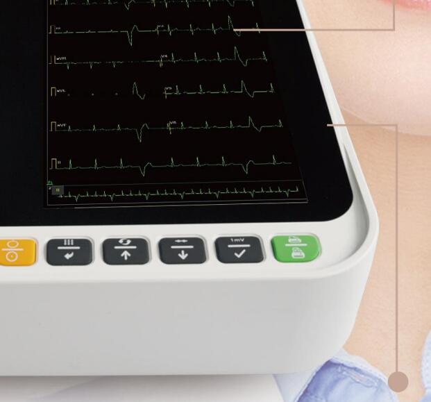 大卫心电图仪4