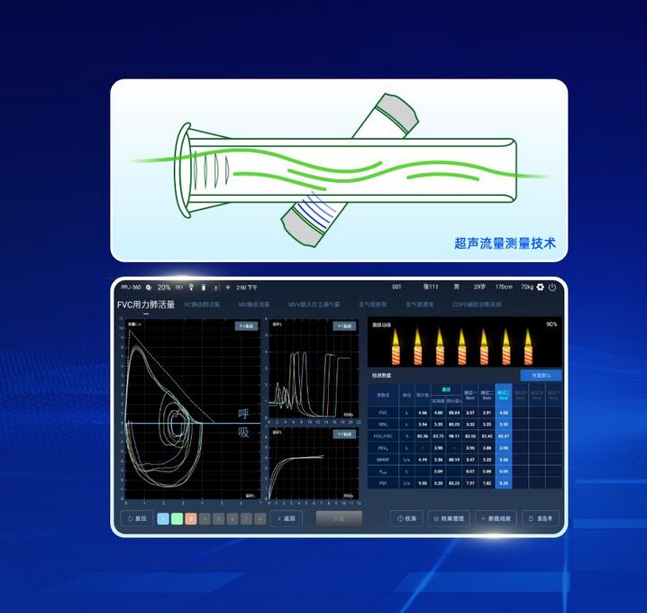 悦琦肺功能仪（小肺）4